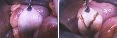 Fig 75-3,4