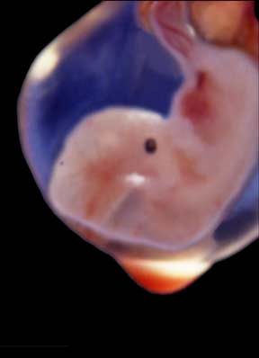 Embryo